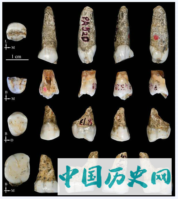 桐梓人牙齿形态研究新进展
