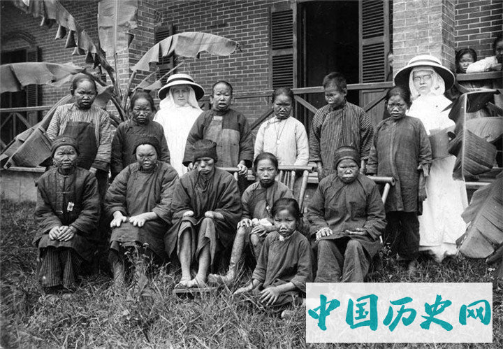 摄影师拍摄的广东地区的麻风病患者，患病后自生自灭