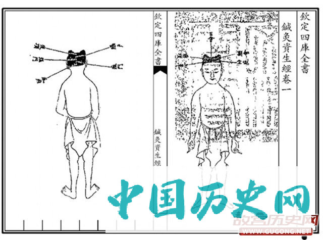 古人控制人口的方法：堕胎、避孕与绝育